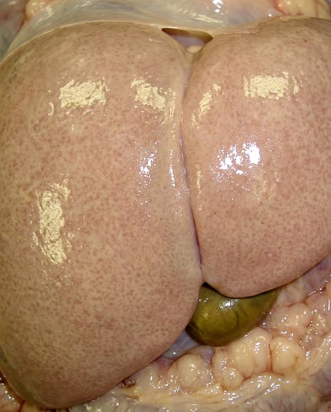 What "normal" on a bladder check actually means