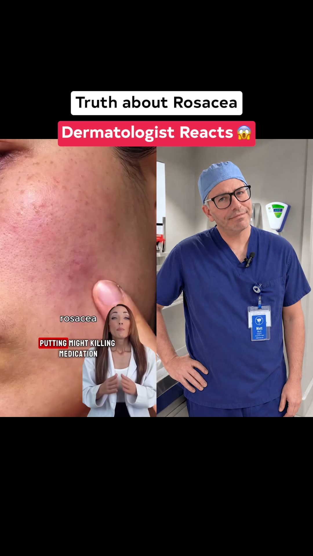 The Rosacea Myth: The Real Reason Flare-Ups Keep Coming Back