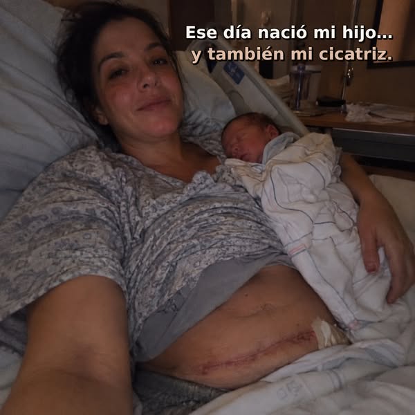 Haz que tu cicatriz se note menos