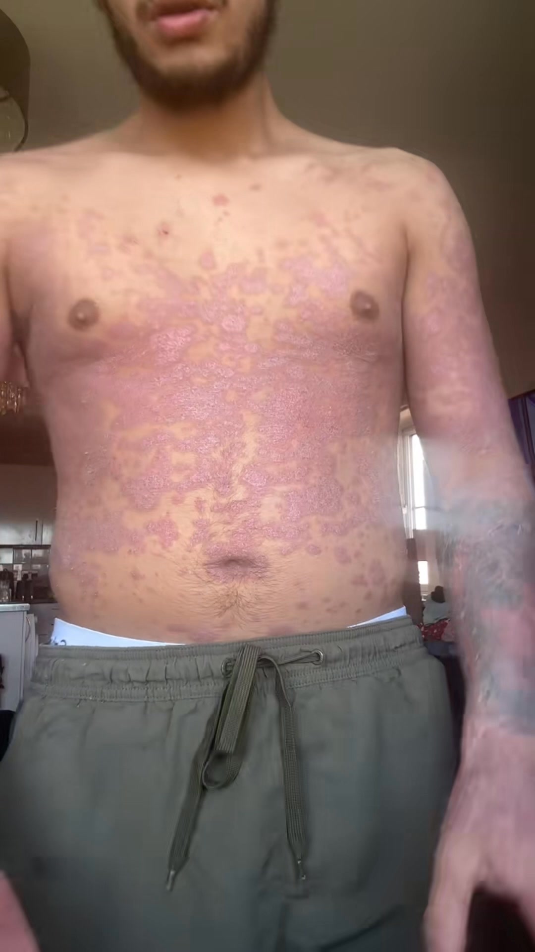 Don't give up on your skin