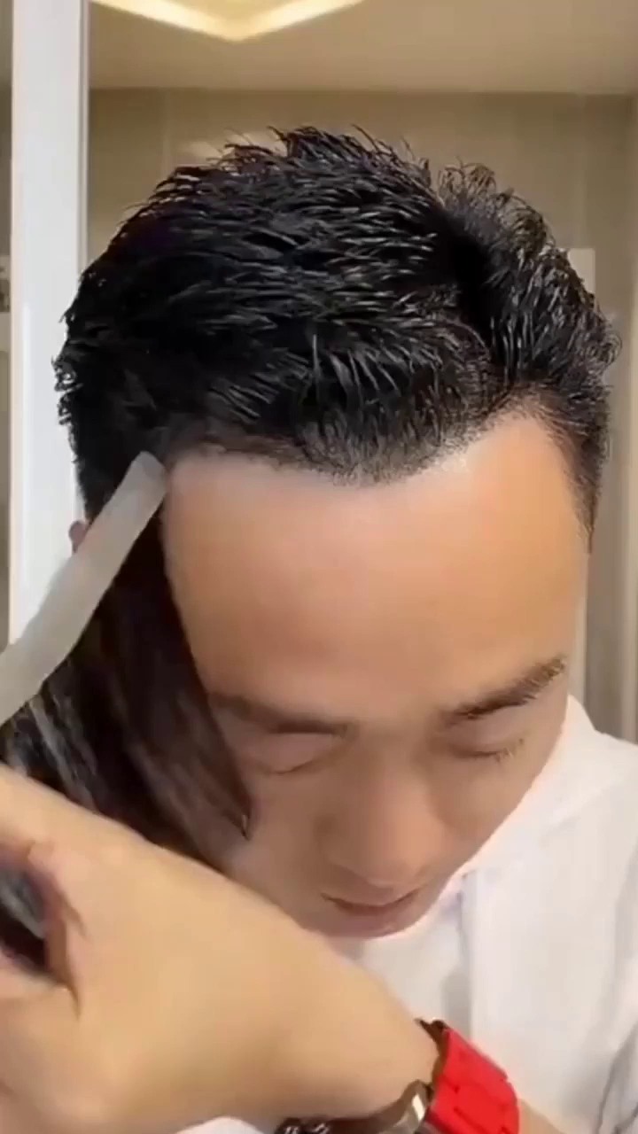 A Guide to Non-Surgical Hair Restoration