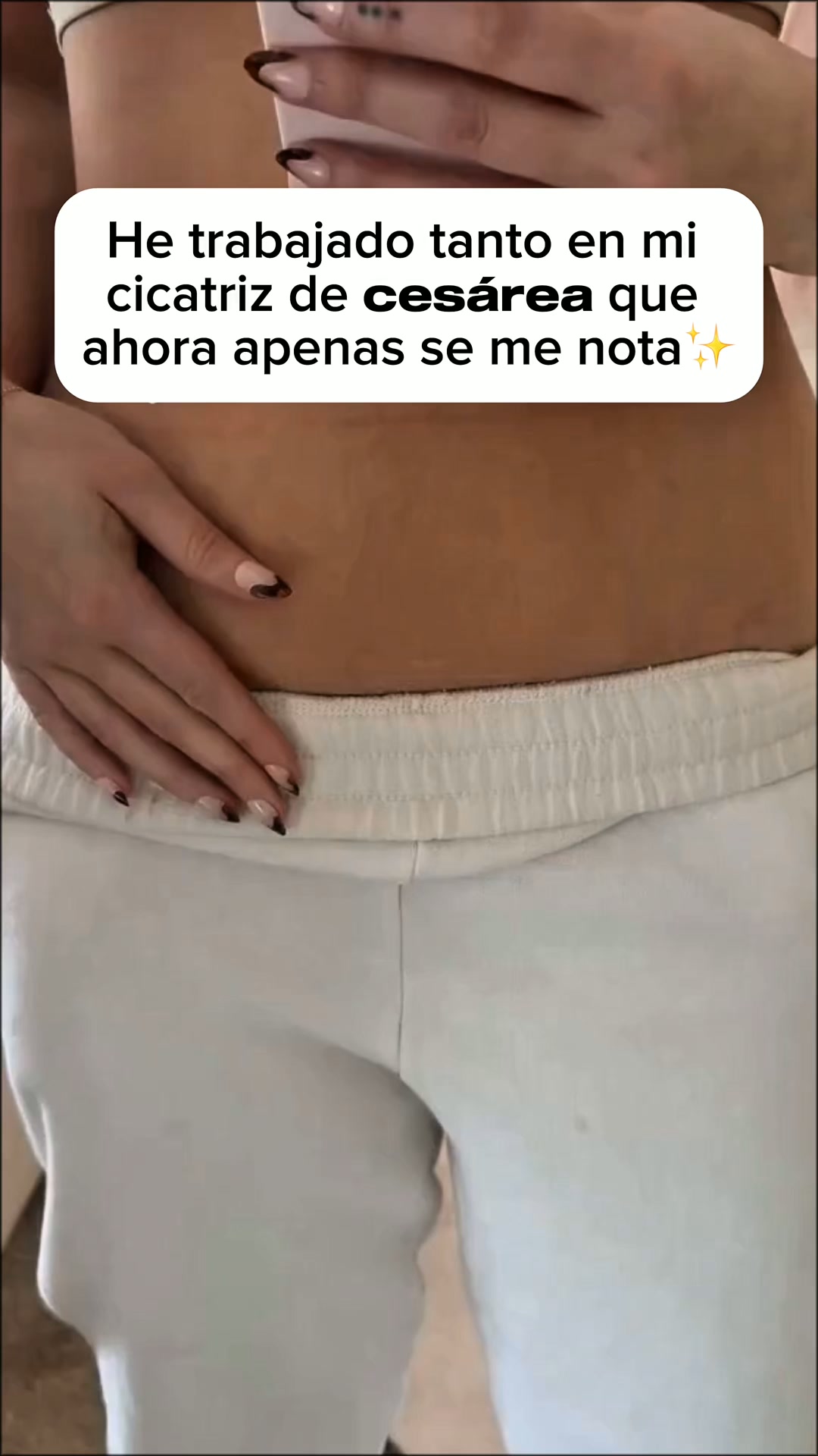 ENVÍO GRATIS 24-48H