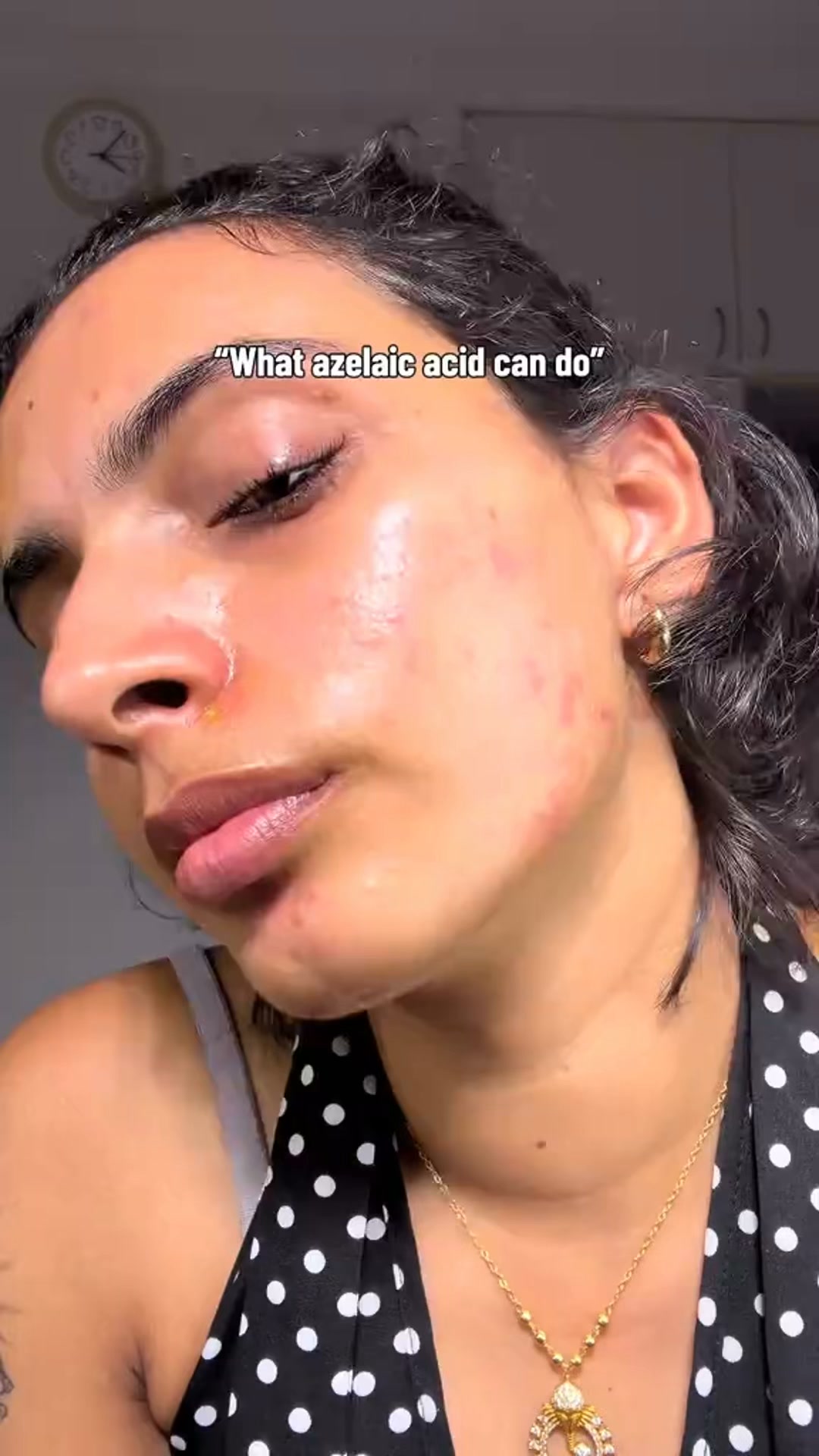 Calmer, Clearer-Looking Skin