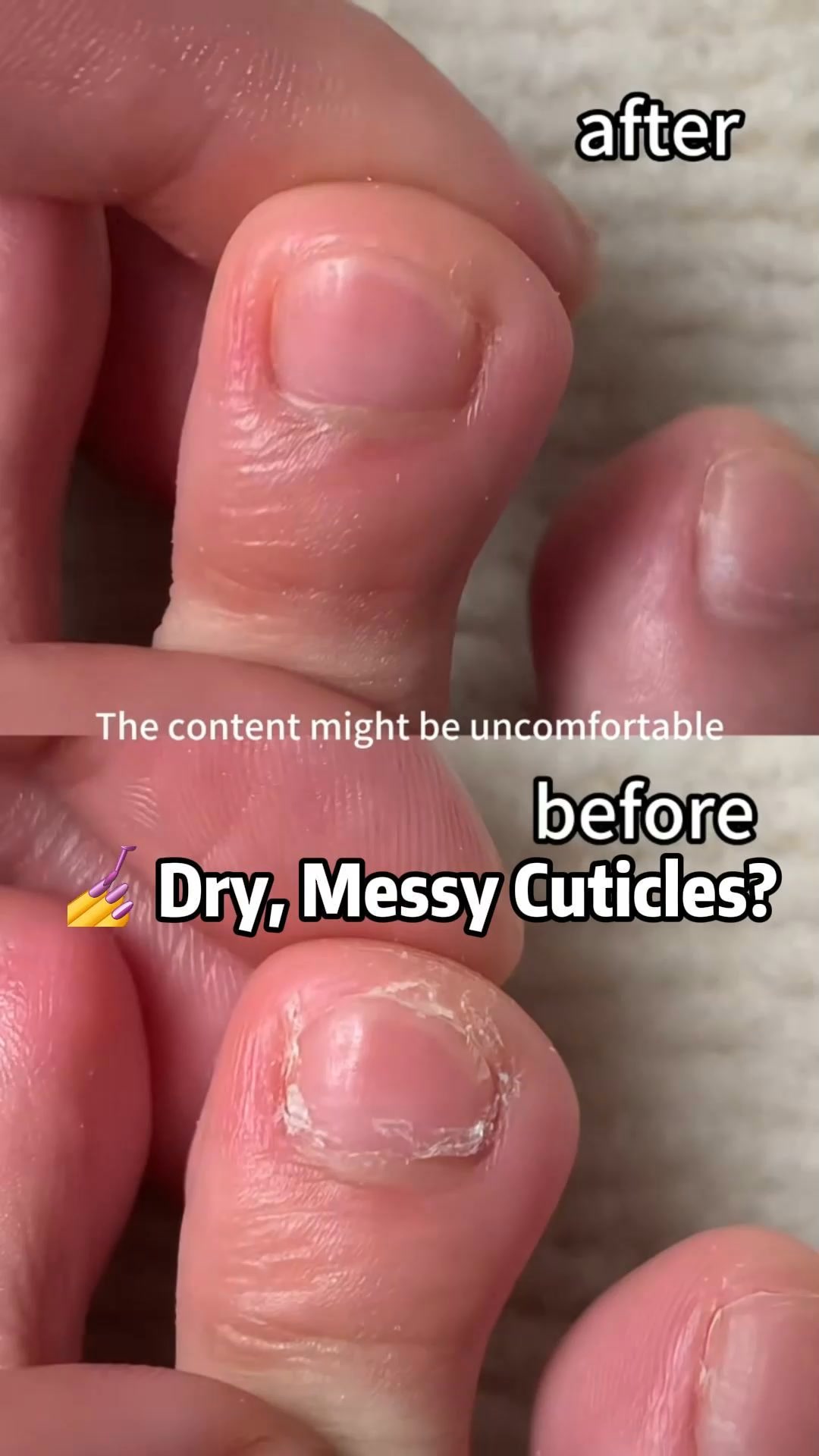 The Cuticle Pen You’ll Wish You Found Sooner