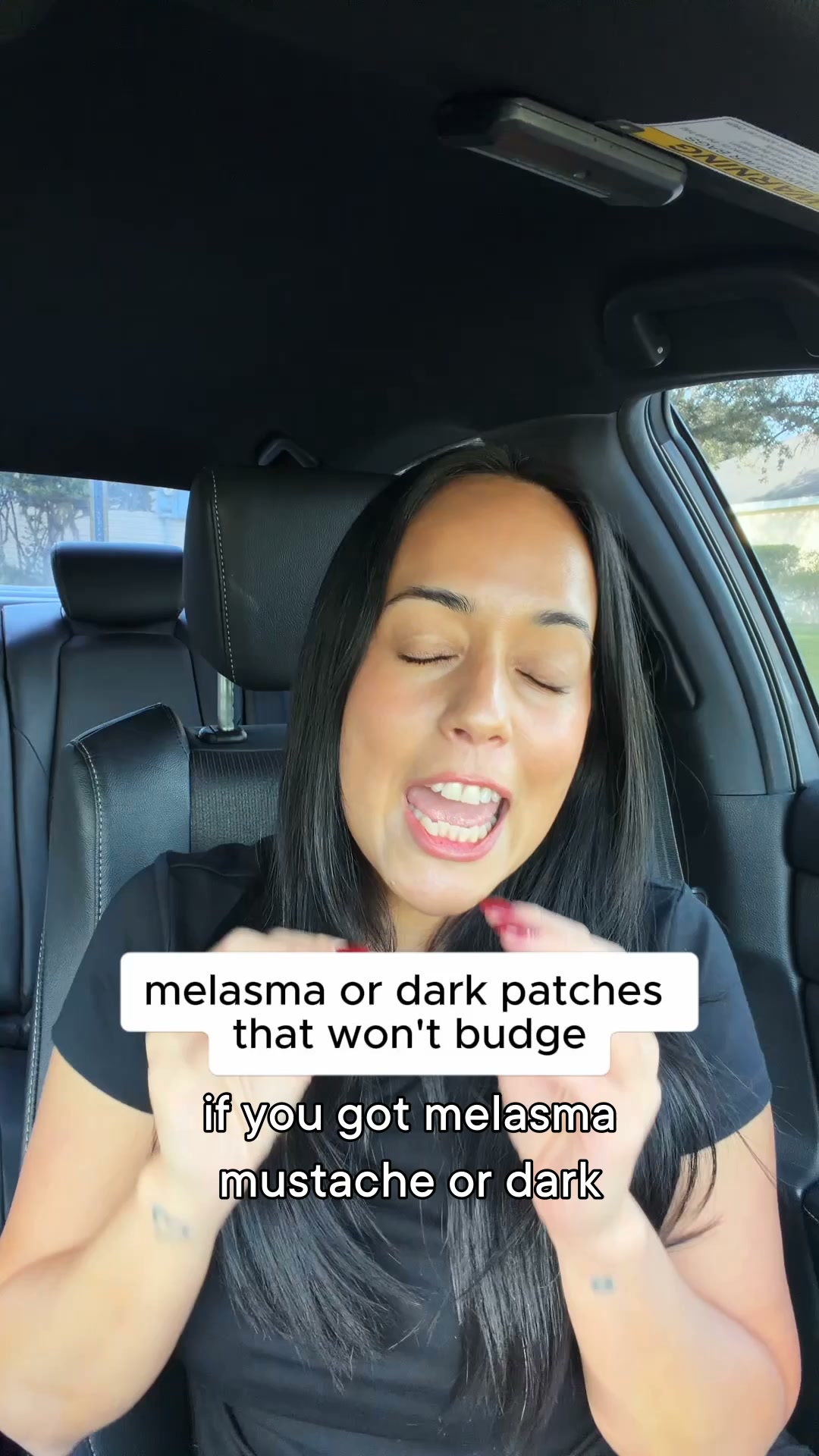 If You've Got a Melasma Moustache, Watch This