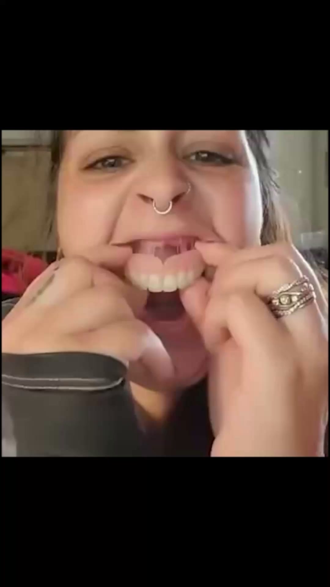 A Better Fit. A More Confident Smile.
