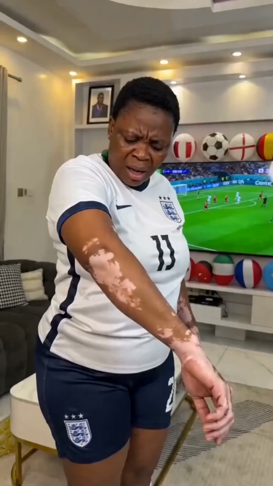 Fast and easy fix for vitiligo.