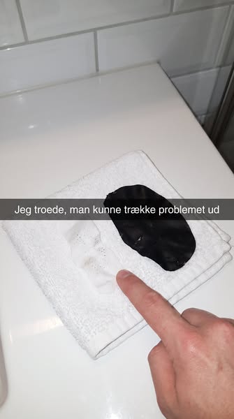 Det her skulle rense mine porer