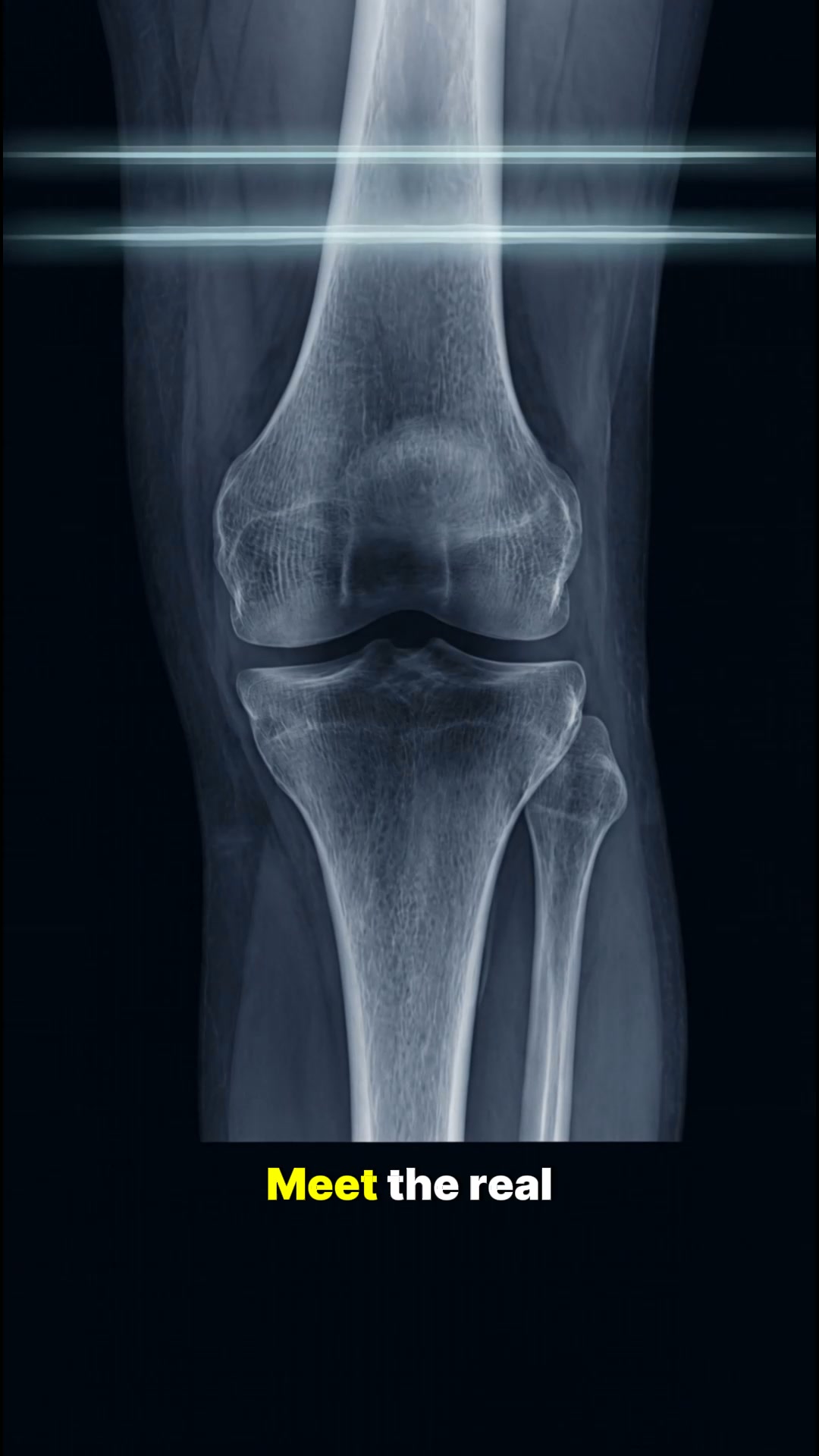 Less Knee Pain in Just 20 Minutes a Day