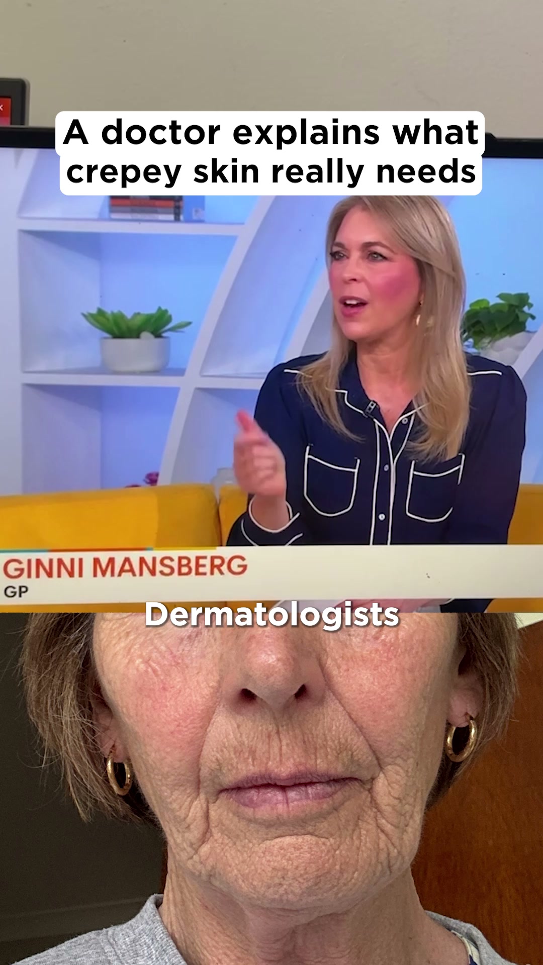 Crepey skin isn't a wrinkle problem