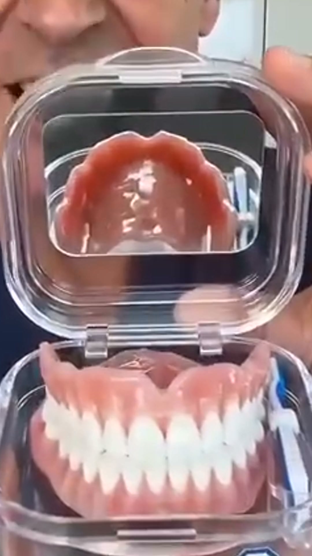 Un sourire naturel instantanément!