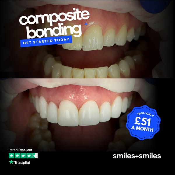 Book In Now For Your Summer Smile