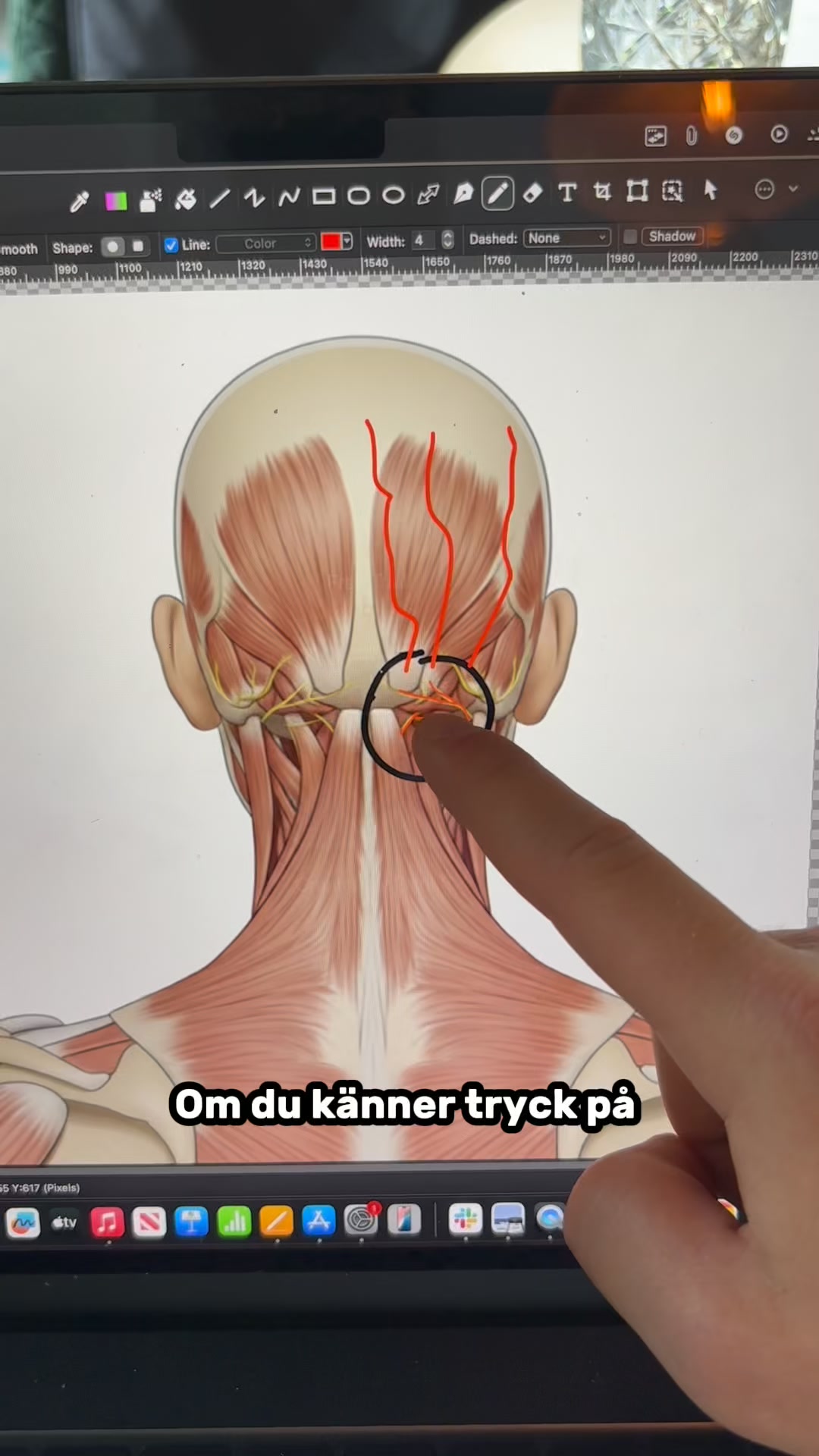 Lindra smärtan i nacken