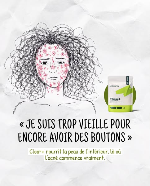 Tout essayé. Ça a vraiment marché.