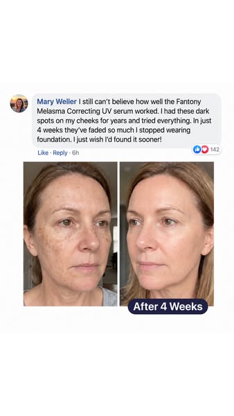 The Dark Spot Myth: The Real Reason Spots Keep Coming Back