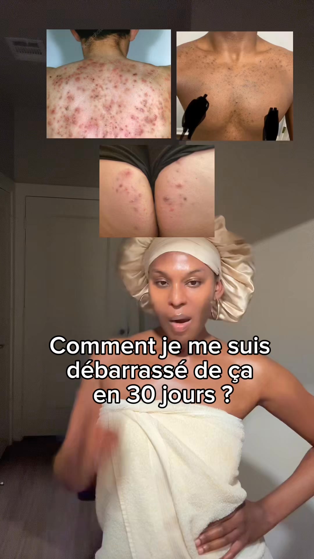 Votre nouvelle routine anti-taches