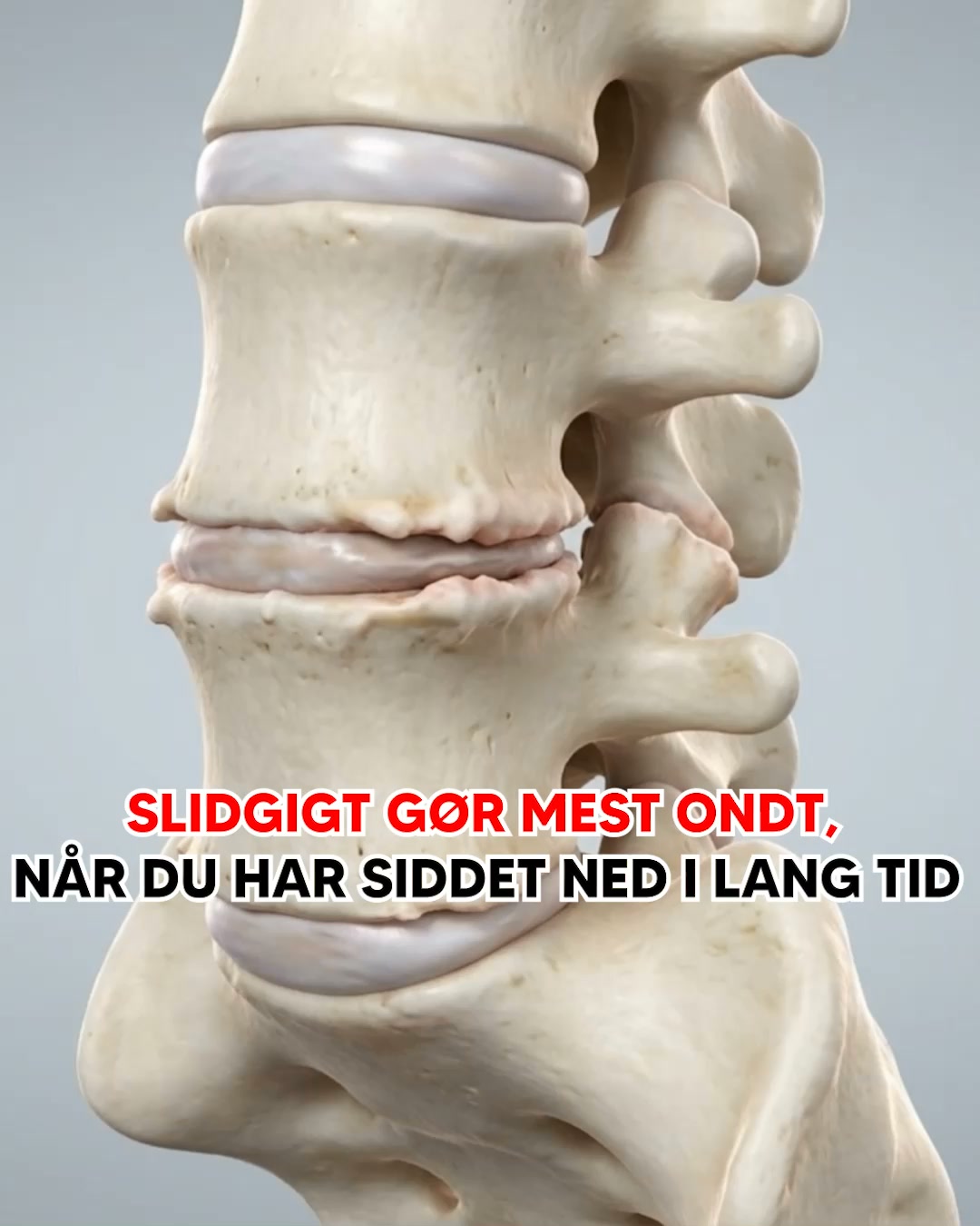 Aflast din slidte ryg med MyComfort Siddepude