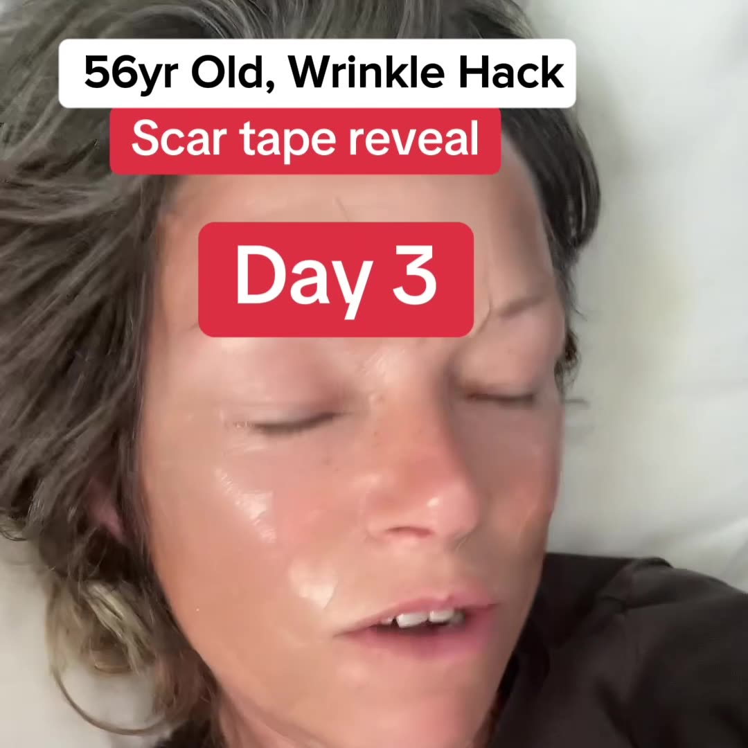 Celebrate Mom: 60% OFF Scarlette Collagen Tape (Limited Time)!