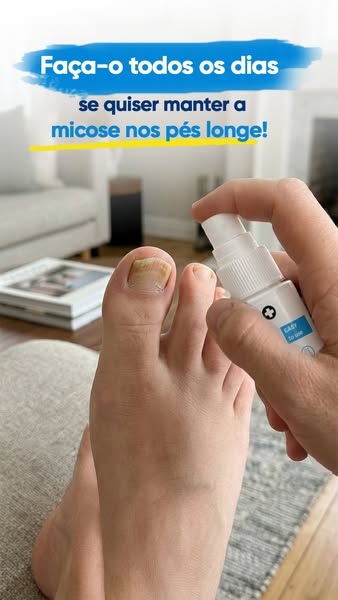 Alívio natural para infeções fúngicas!
