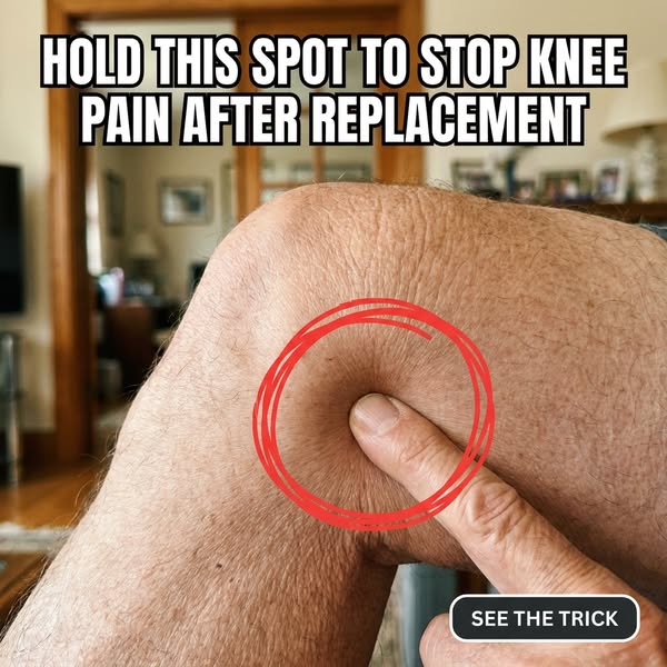 Read This If You Had A Knee Replacement