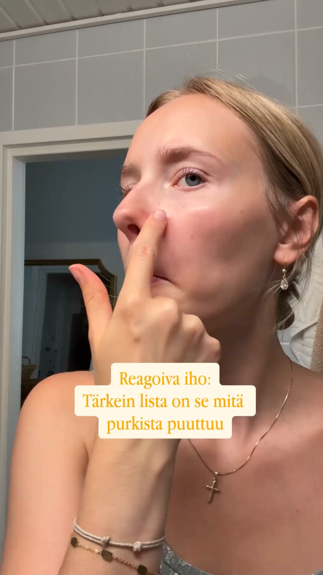 Helpotus kiukuttelevalle iholle