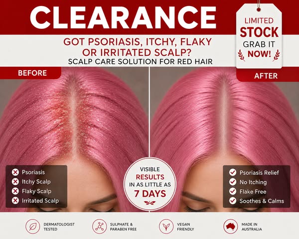 HEAL YOUR SCALP PSORIASIS in 10 Mins a Day