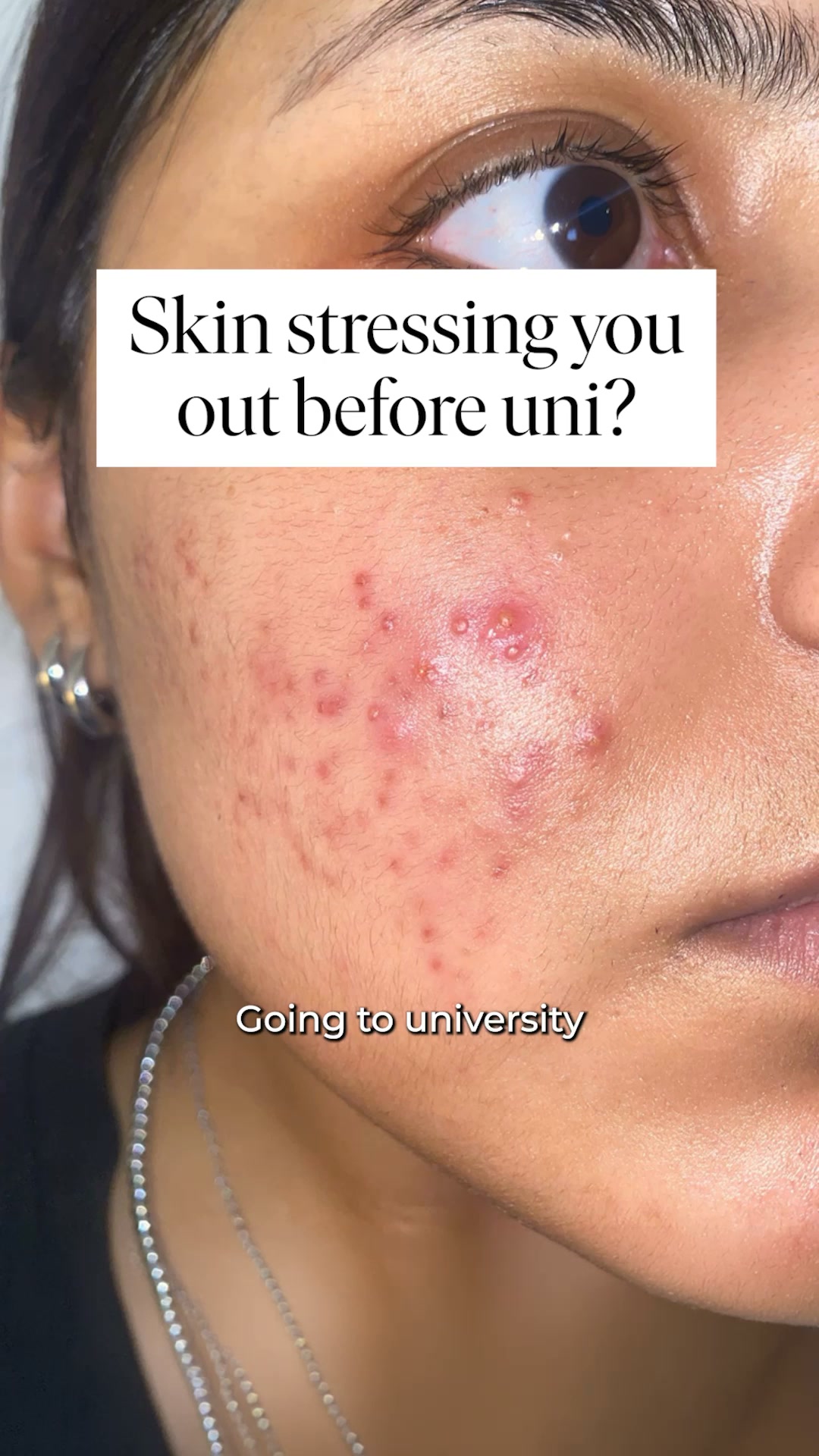 A skin treatment that actually works
