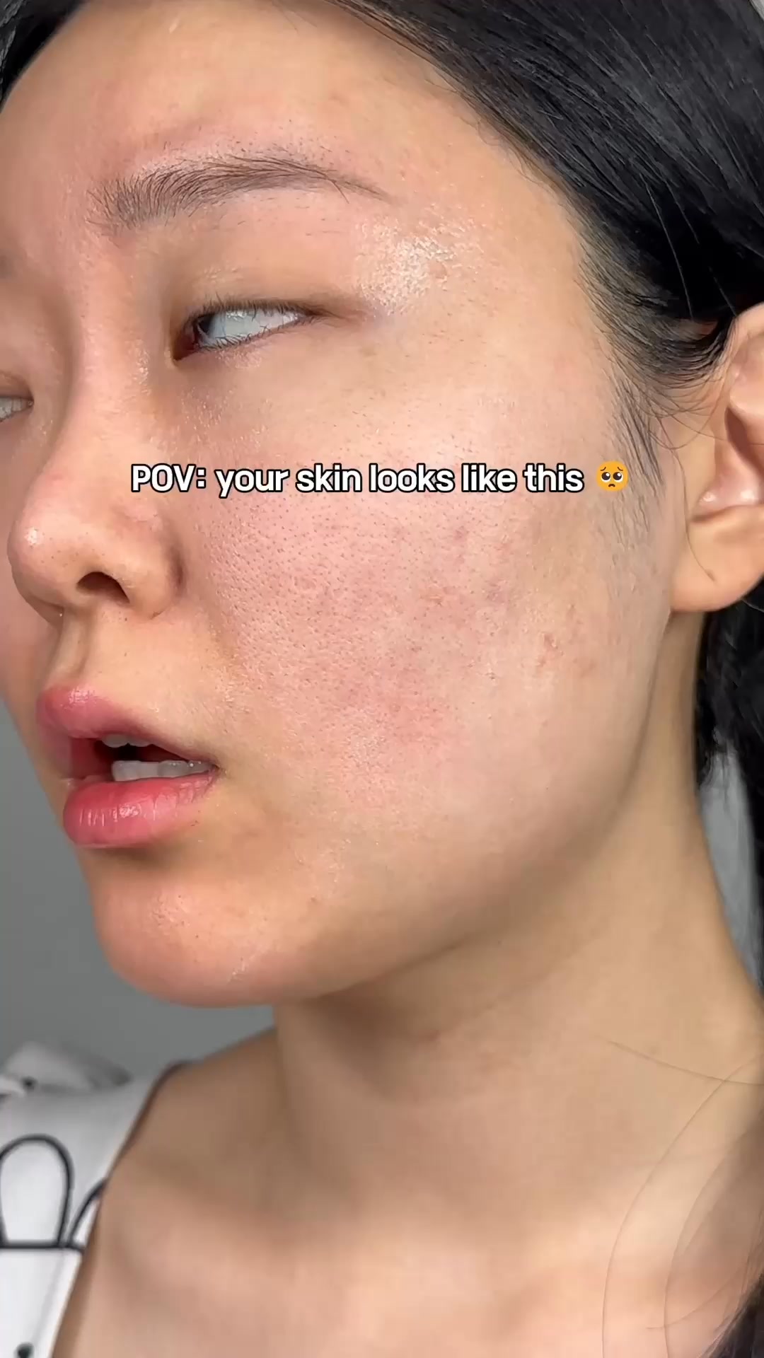 What Is Your Skin Missing?