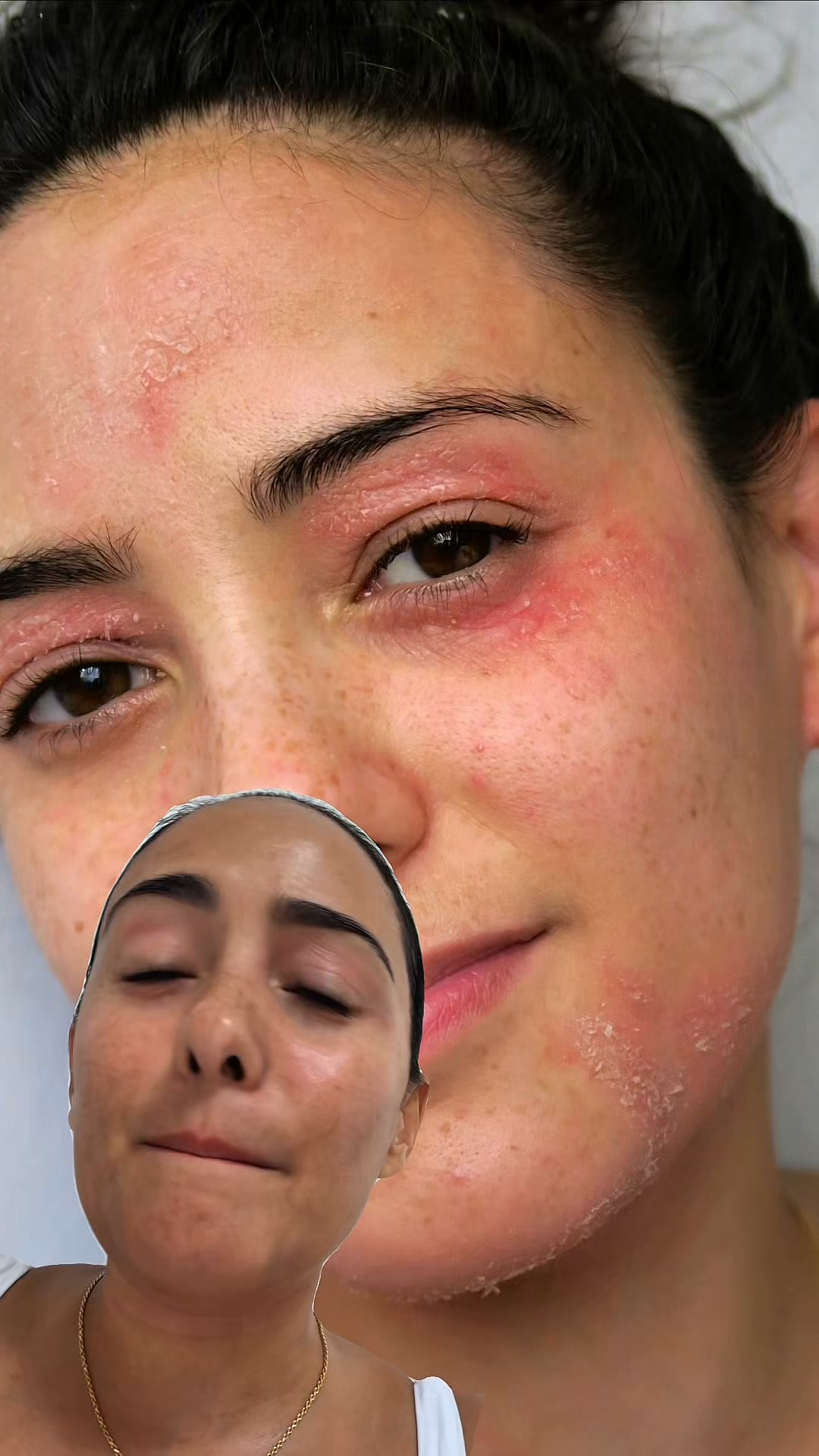 The Award-Winning Moisturiser for Sensitive Skin