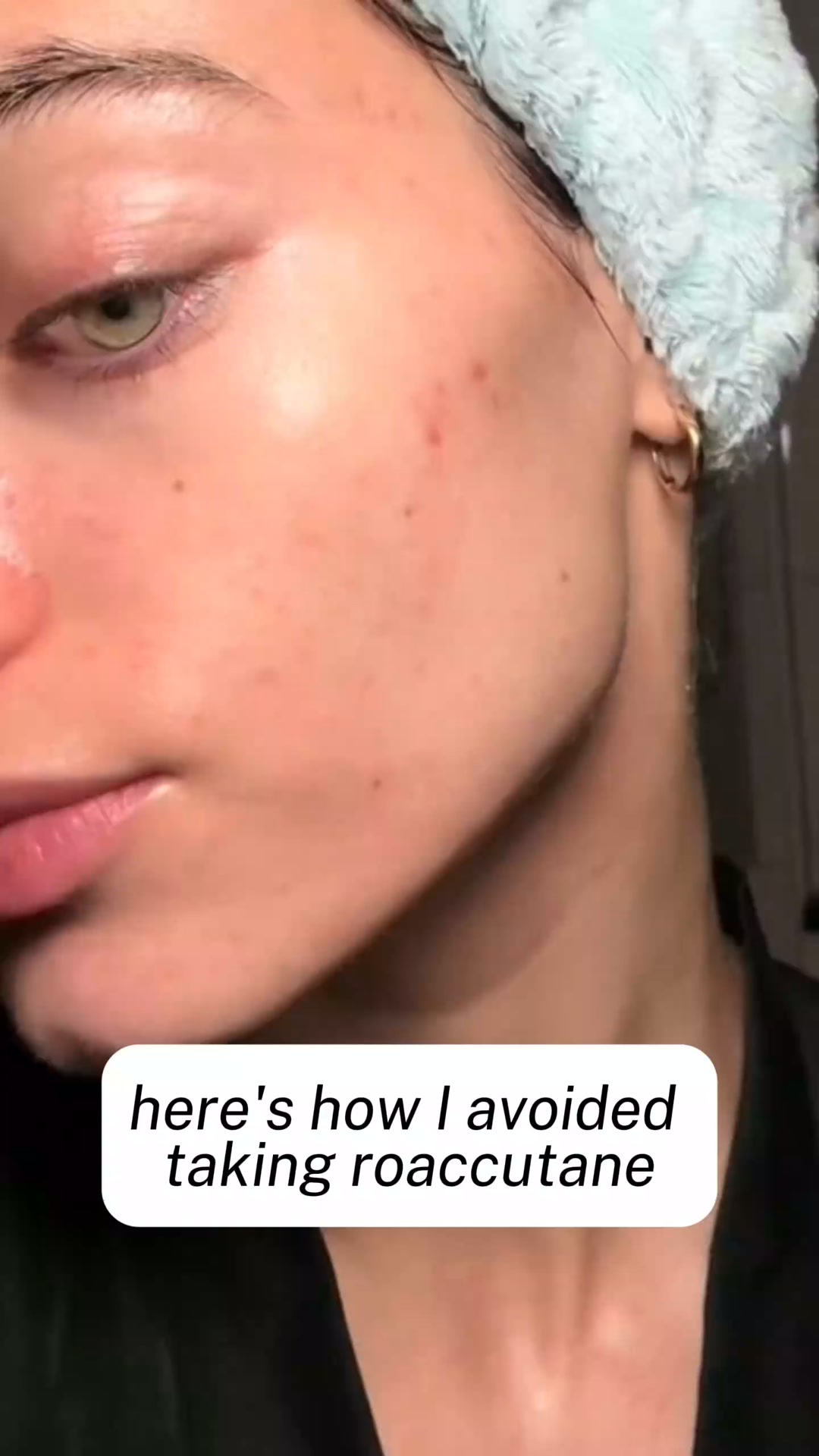 Clear & Healthy Skin