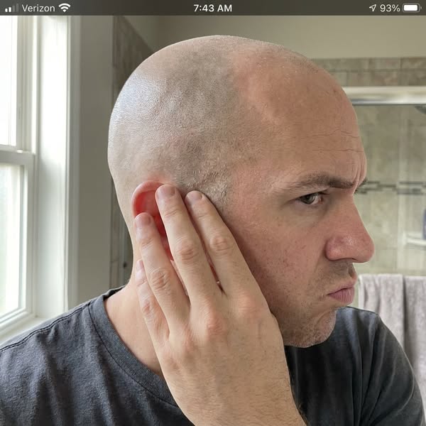 The Shave Followed Me