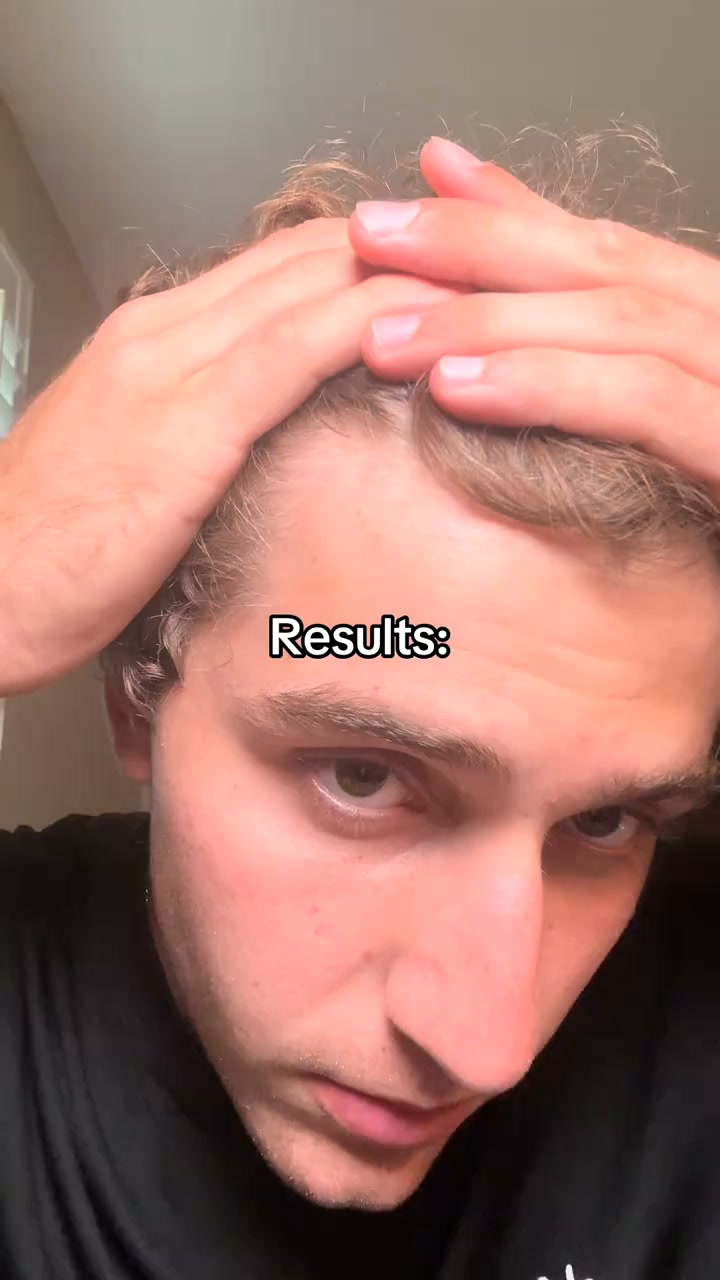 Restore Your Hair