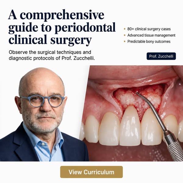 Zucchelli Channel — Master Periodontal Surgery