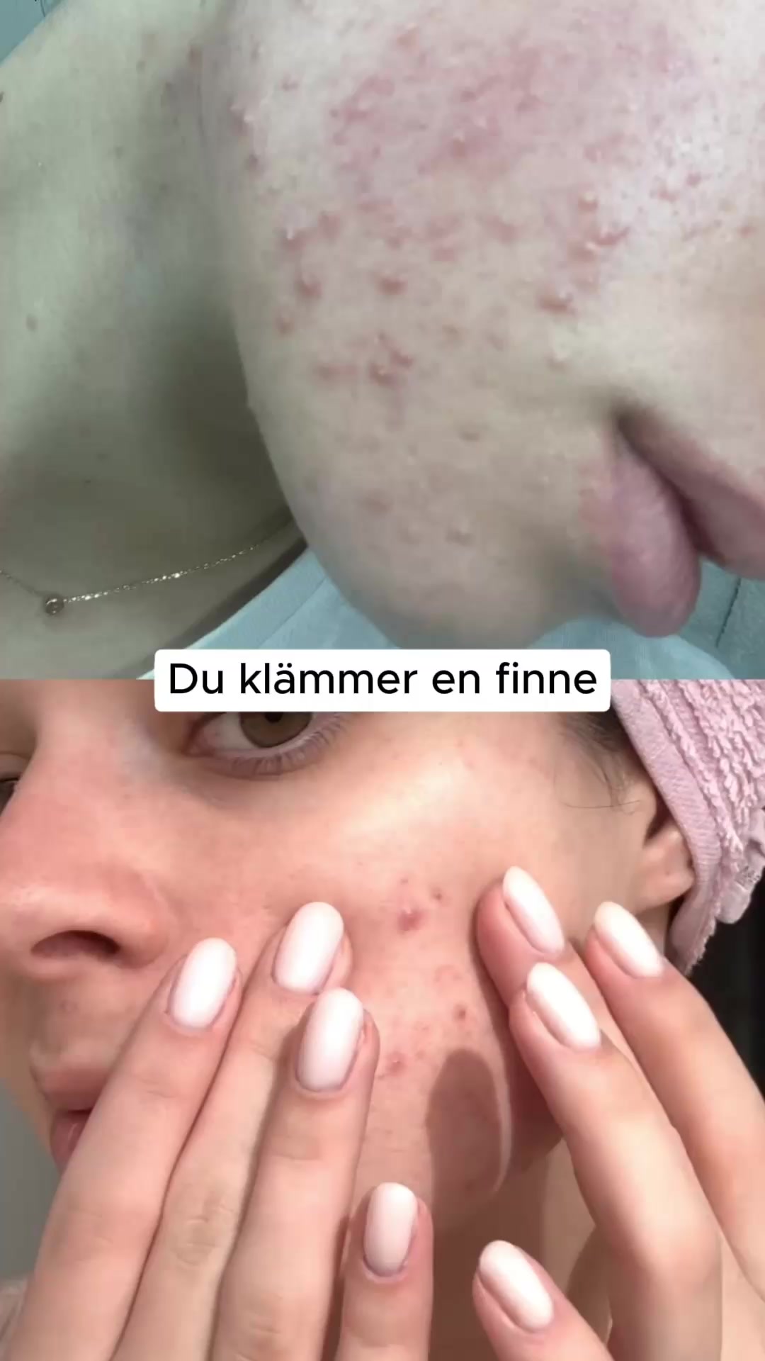 Känn dig bekväm med din hud igen
