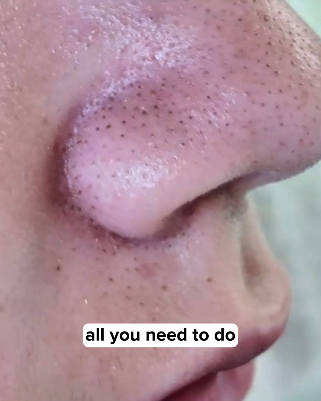 Get rid of spots now!