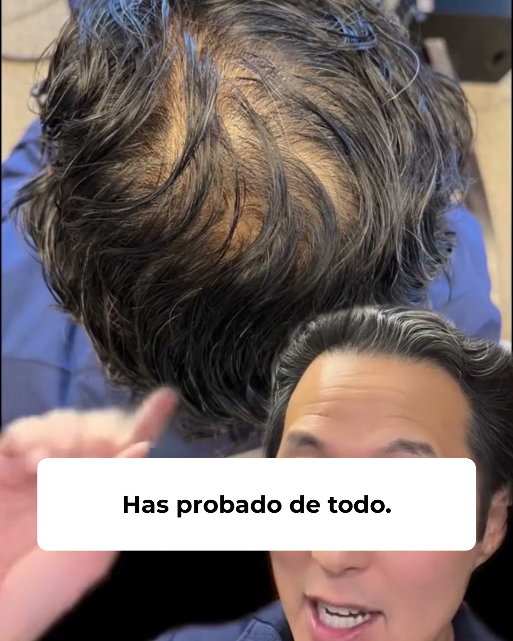Reactiva tus folículos naturalmente