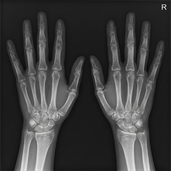 Terrified of your DEXA? Read this