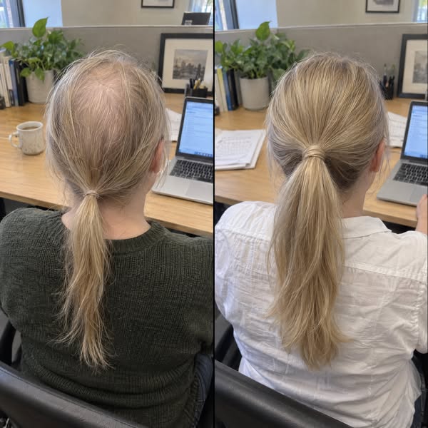 If Your Hair Is Thinning Read This