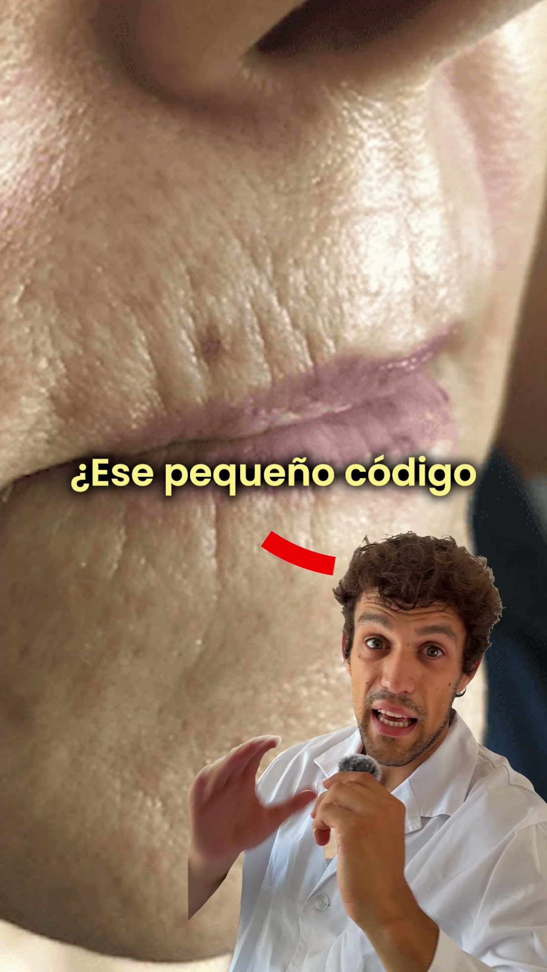 Descubre la micro-infusión Renovae