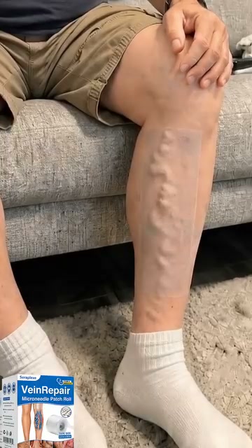 Visible Leg-Care Results in as Little as 7 Days
