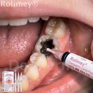 Cavity-Repair Natural Enamel Filling Gel