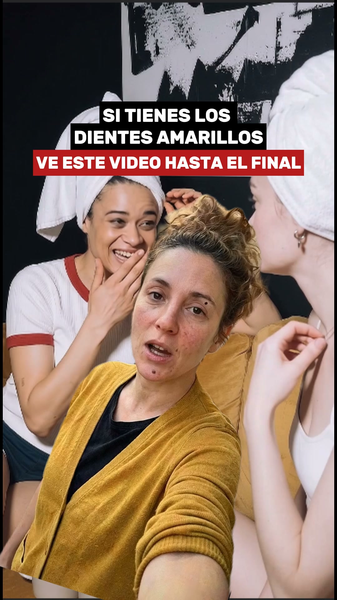 Unidades Limitadas