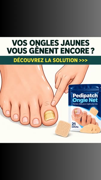Stop aux ongles qui vous complexent ! 1 PACK + 1 - 2+ 3 OFFERTS