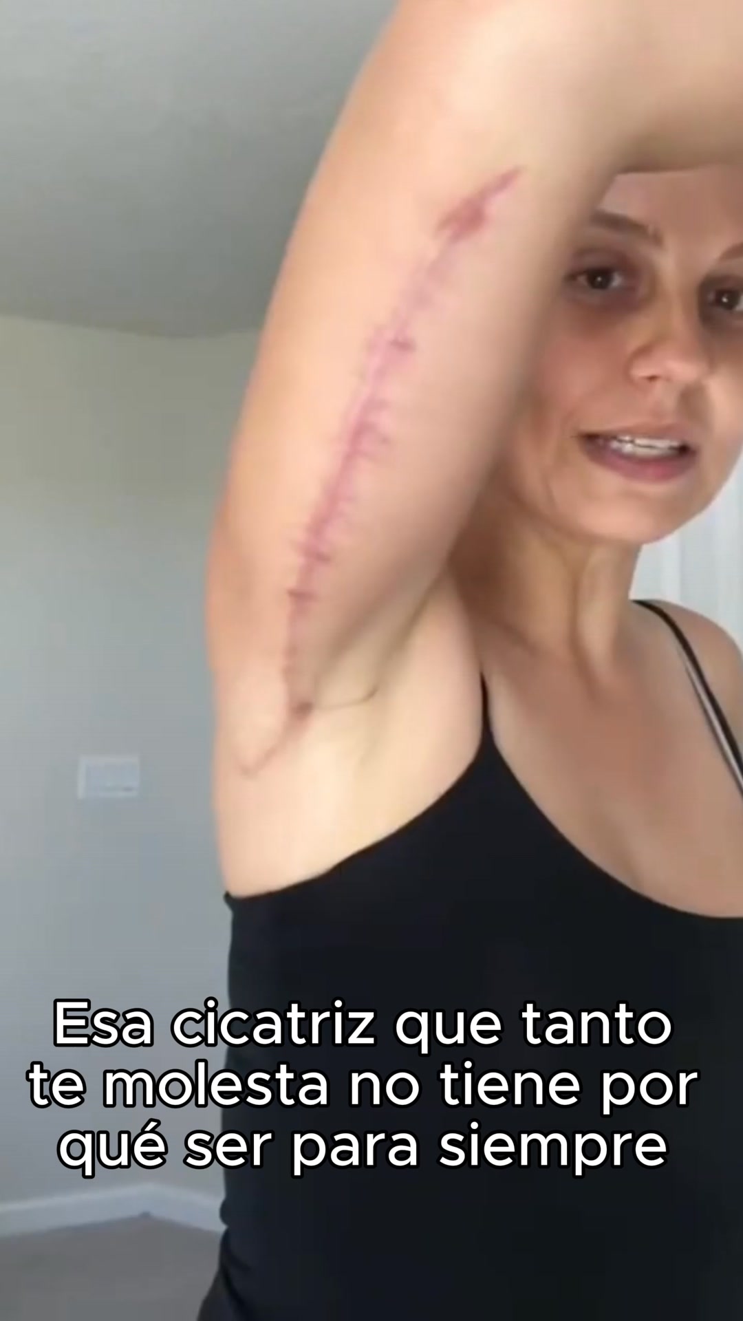 Envío Gratis - Entrega 24-48 horas