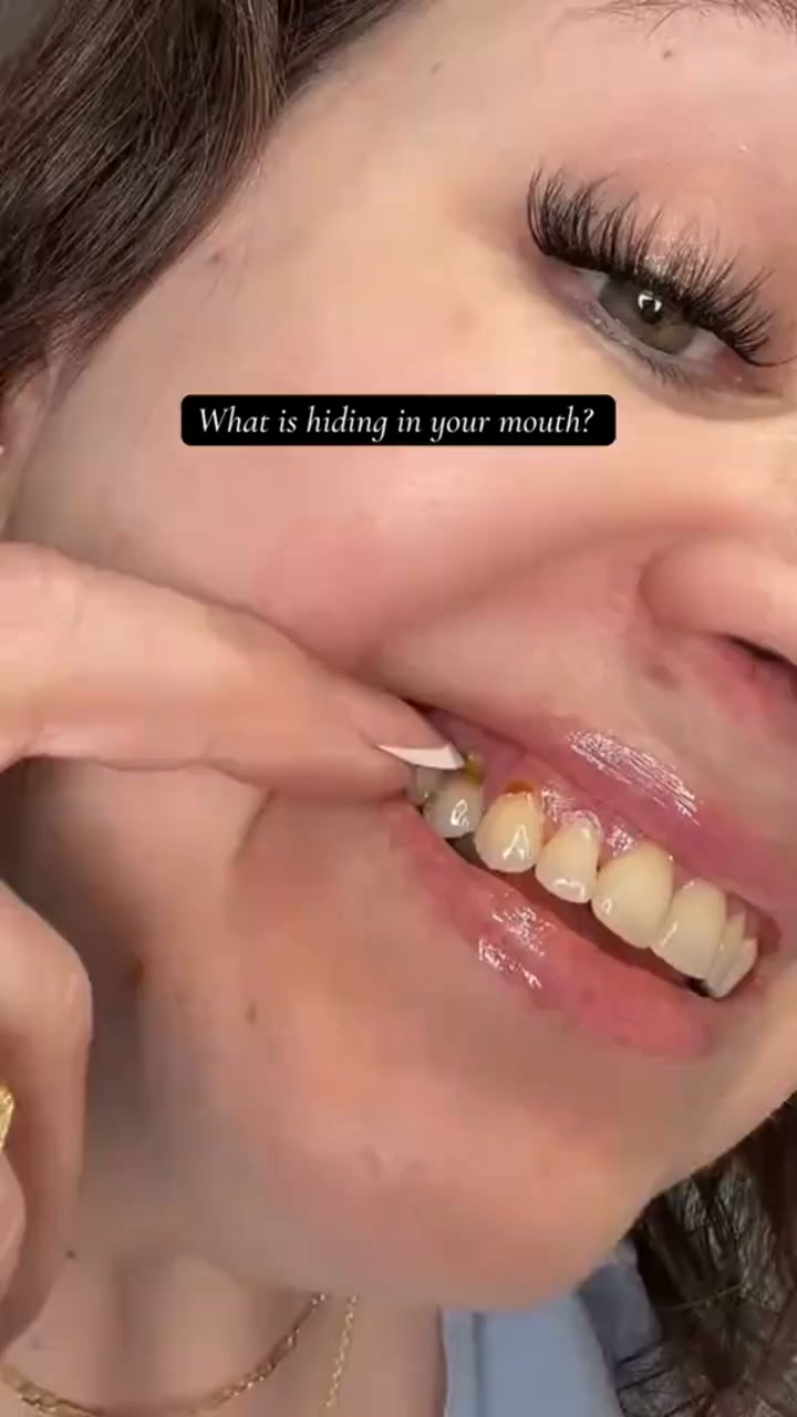 (Urgency & Offer): Save Your Teeth! Buy 2 Get 1 FREE Today