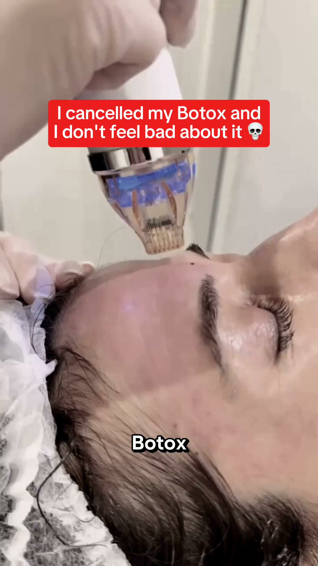£4,800 on Botox, Beaten by a £4 Mask