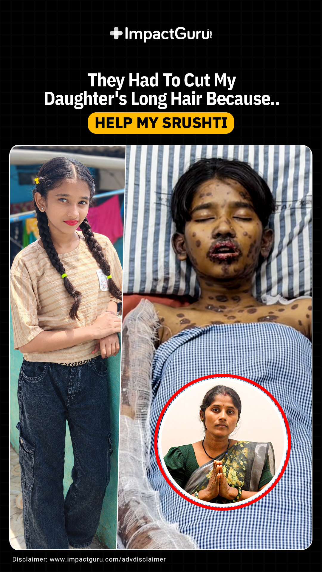 My Daughter Can’t Walk, Speak, Or Even Eat. Save Srushti!