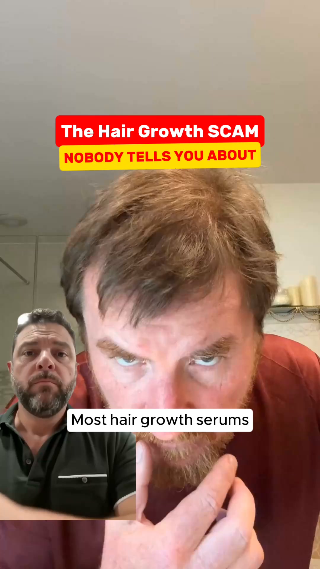Less Scalp Showing Starts Here