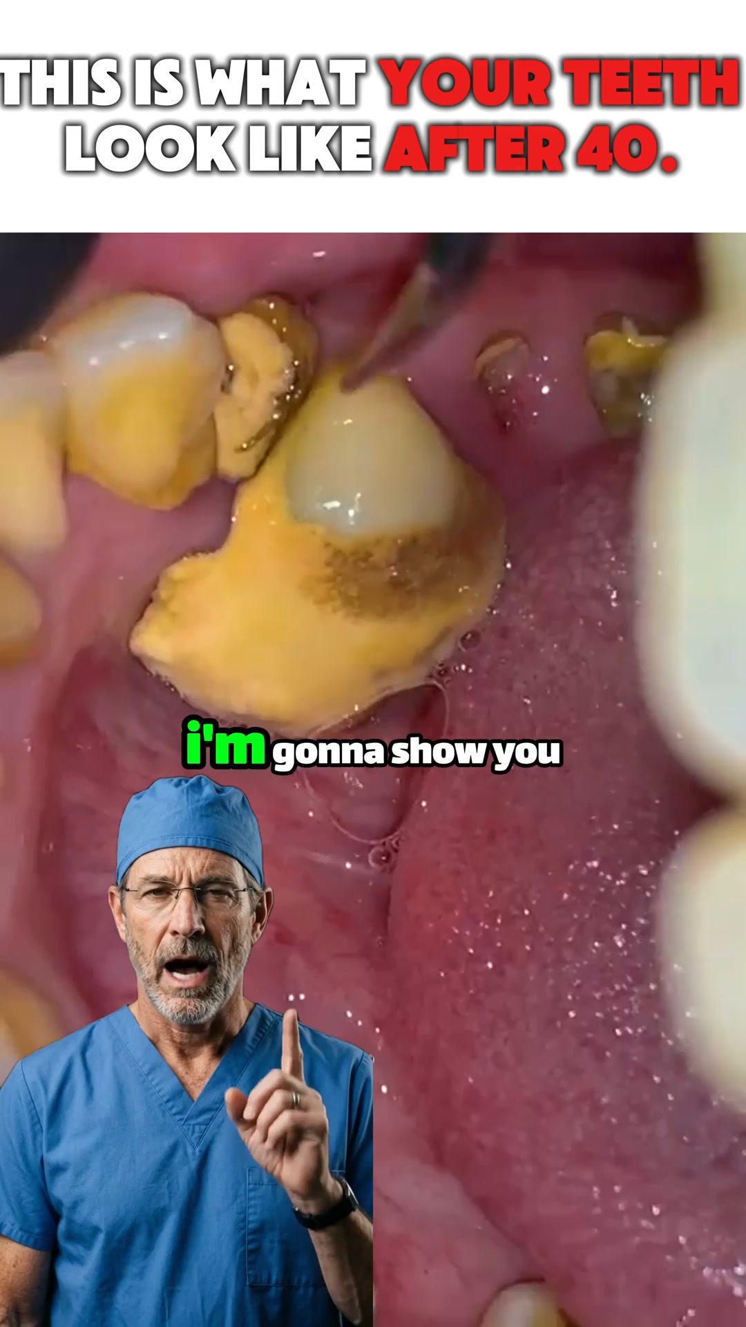 Dentist Developed — Whiten Safely, Without the Sensitivity