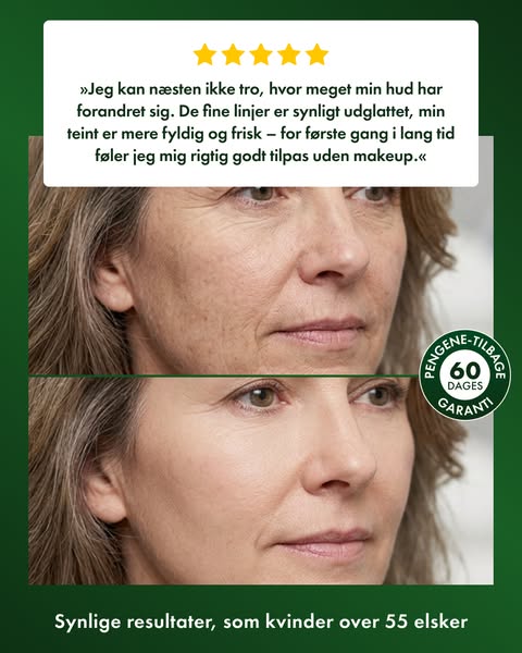 Glattere hud – eller pengene tilbage